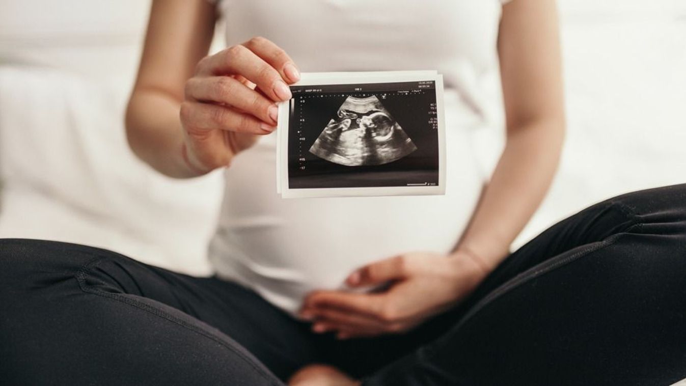Csodás fotón közölte a hírt: babát vár a gyönyörű magyar színésznő