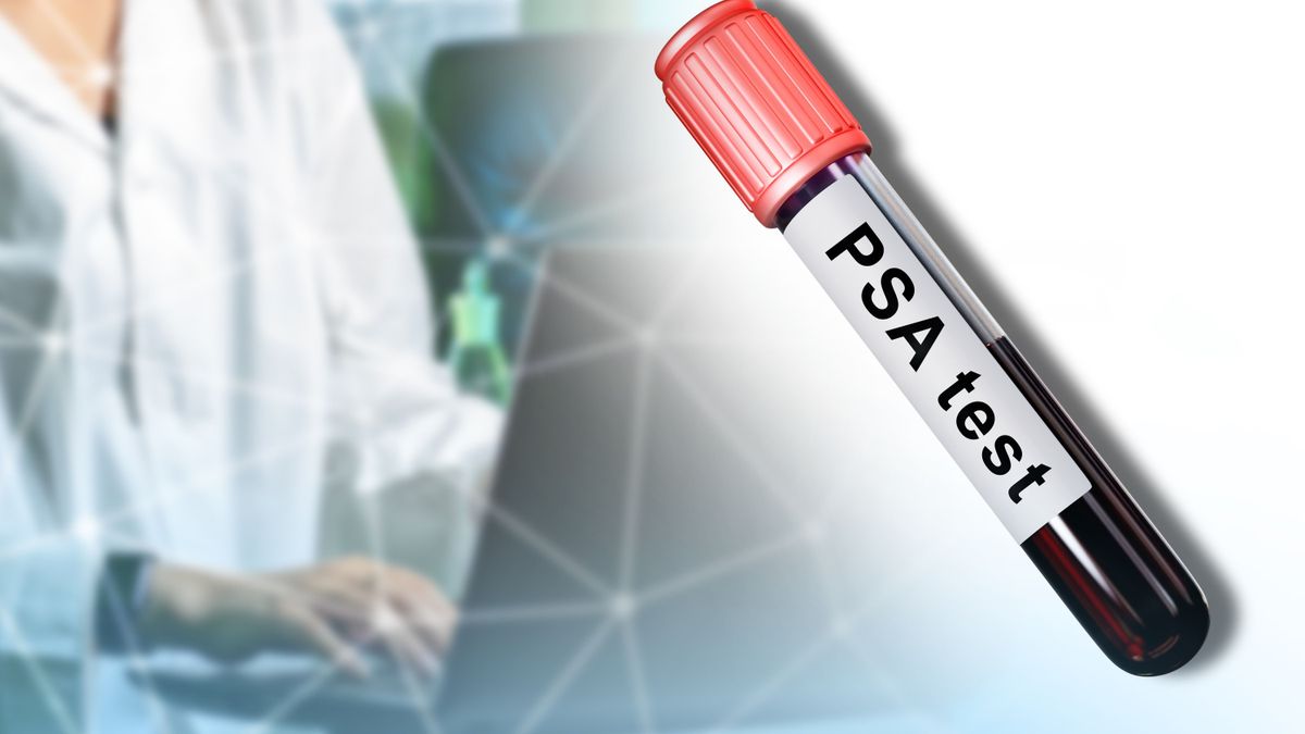 Lehet jelentkezni ingyenes PSA-szűrésre